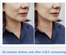 Load image into Gallery viewer, New Rowan Aqua Peel 4 Pro PLUS Complete Skincare Facial Aesthetic System with  Ultrasonic J-Peel, Electroporation and Electromyostimulation