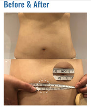 Load image into Gallery viewer, New Cool Fit Cryo Lipolysis Non Surgical Fat Reduction and Cellulite Removal System