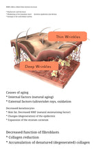Load image into Gallery viewer, Thermatrix Fractional RF Skin Resurfacing Device with Perfect Pin Technology