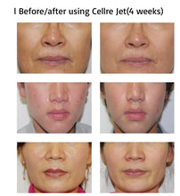 Load image into Gallery viewer, Hybrid Pico Jet Needle Free Oxygen Injection Drug Delivery System for Skin and Hair