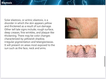 Load image into Gallery viewer, New Plamingo Plasma Energy Skincare System for Face, Scalp, Eyelids