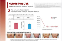 Load image into Gallery viewer, Hybrid Pico Jet Needle Free Oxygen Injection Drug Delivery System for Skin and Hair