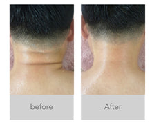 Load image into Gallery viewer, EnergyUp Microcurrent Body Sculpting EMS Muscle Stimulating Device