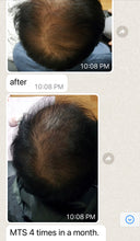 Load image into Gallery viewer, Just Science All Natural HG Hair Restoration Growth Factors Ampoules