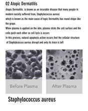 Load image into Gallery viewer, New Plamingo Plasma Energy Skincare System for Face, Scalp, Eyelids