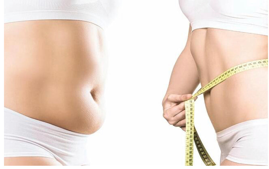 Body Contouring FAQ’s Finding the Right Treatment for Your Business