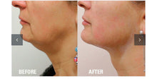 Load image into Gallery viewer, Th4 HIFU SONO MTS Facial Rejuvenation Hydration Skincare  System
