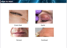 Load image into Gallery viewer, New Plamingo Plasma Energy Skincare System for Face, Scalp, Eyelids
